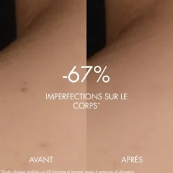 Sérum Et Booster><noscript><img width=