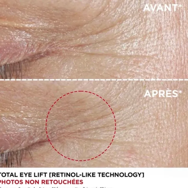 Soin Yeux & Lèvres|Soin Jour & Nuit>CLARINS Total Eye Lift - Contour des yeux anti-âge Soin yeux anti-rides - Recharge