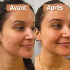 Sérum Et Booster|Soin Naturel & Ecoresponsable><noscript><img width=