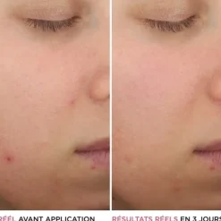 Soin Spécifique Visage|Sérum Et Booster><noscript><img width=