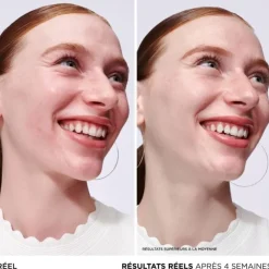 Sérum Et Booster|Soin Naturel & Ecoresponsable>It Cosmetics Bye bye Redness                Sérum Anti-Rougeurs à l'Avoine Colloïdale