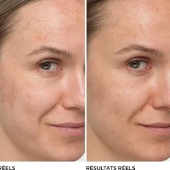 Soin De Jour><noscript><img width=