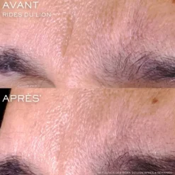 Soin Jour & Nuit|Sérum Et Booster><noscript><img width=