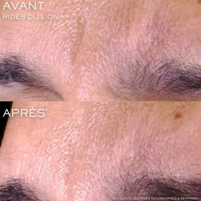 Soin Jour & Nuit|Sérum Et Booster>LANCÔME Rénergie C.R.x. Triple Sérum Rétinol Sérum Visage