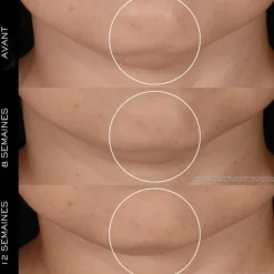 Soin Jour & Nuit><noscript><img width=